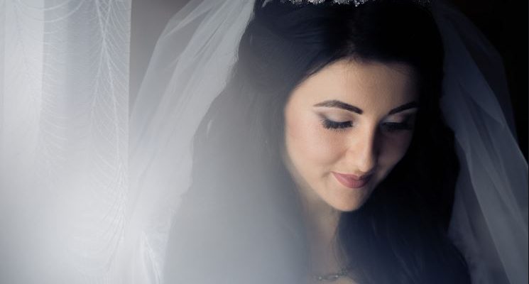 Botox Injections are Becoming Increasingly Popular For Brides Everywhere